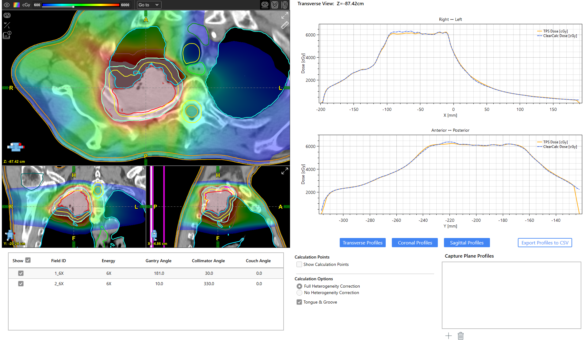 ClearCalc software interface for Plan profiles