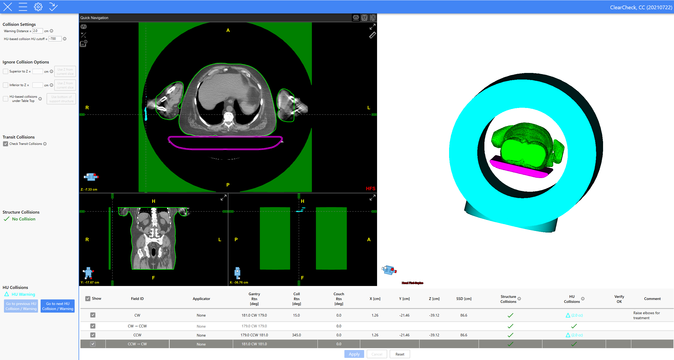 Screenshot of the Collision Check interface for ClearCheck
