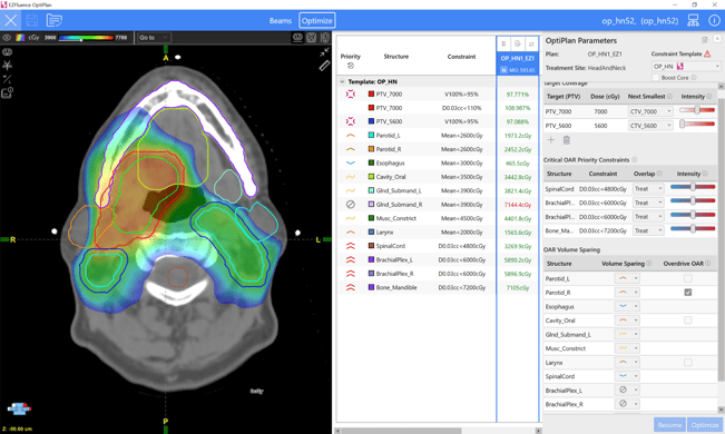 OptiPlan User Interface Automated VMAT Planning